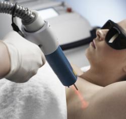 Laser Hair Removal Guarantee Brisbane